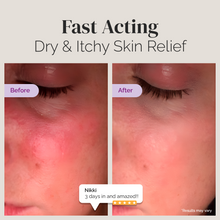 Load image into Gallery viewer, Mother of All Creams (For Ultra Sensitive Skin 4.5 oz)