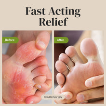 Load image into Gallery viewer, Antifungal Balm