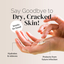 Load image into Gallery viewer, Antifungal Balm